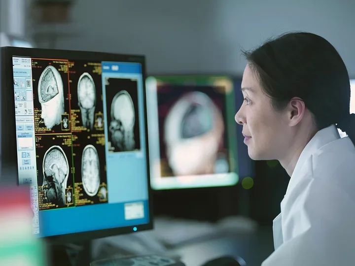 A healthcare worker examines images of the brain.
